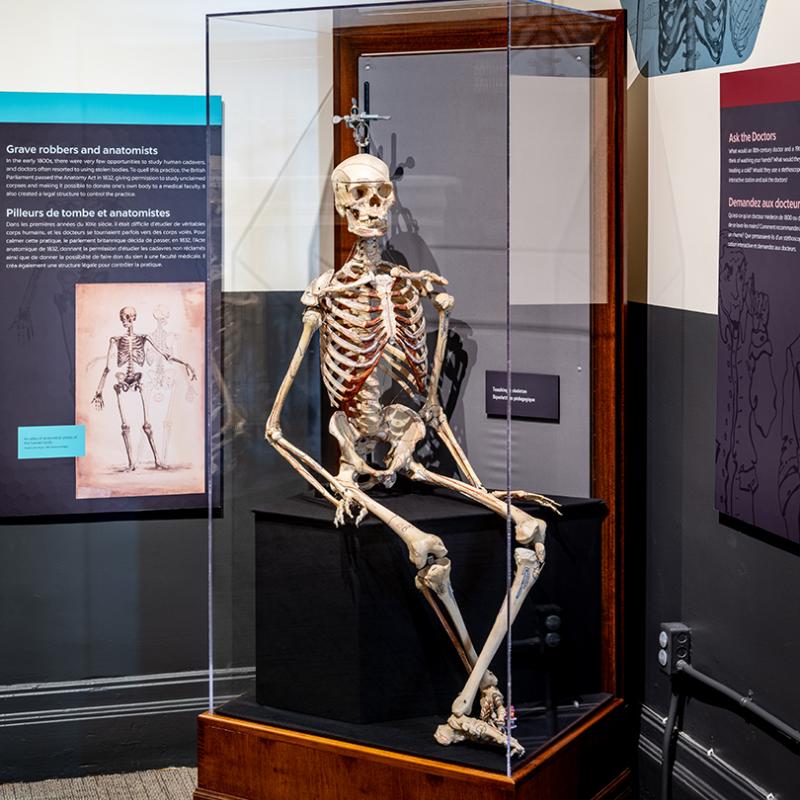 A full skeleton sits on a black box, inside a display case.