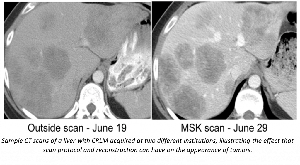 Outside and MSK Scans