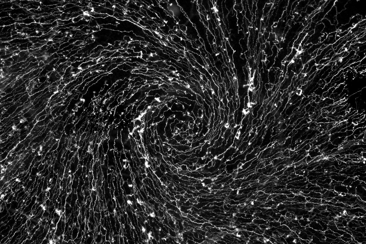 [The structural βIII-tubulin component of mouse corneal nerves at their convergence point.]